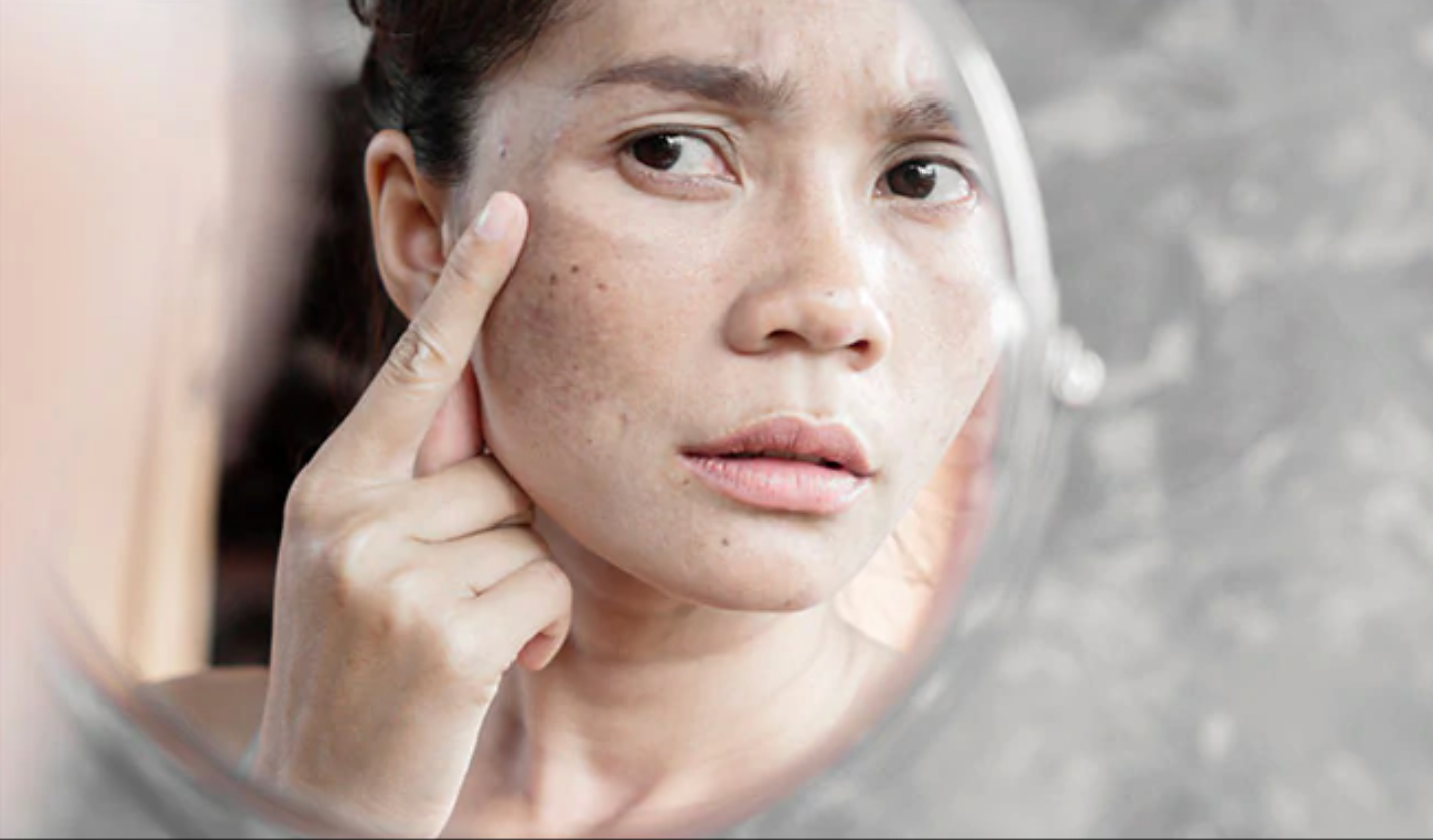 how-to-get-rid-of-dark-spots-on-your-skin